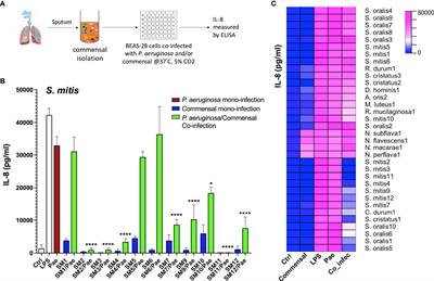 Commensal Bacteria in the Cystic Fibrosis Airway Microbiome Reduce P. aeruginosa Induced Inflammation